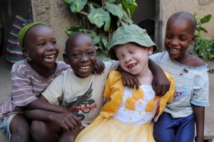 Международный день распространения информации об альбинизме