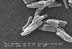 Роберт Кох выступил с сенсационным сообщением - ему удалось выделить бактерию, вызывающую туберкулез