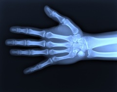 Физик Вильгельм Рентген открыл «рентгеновские лучи»