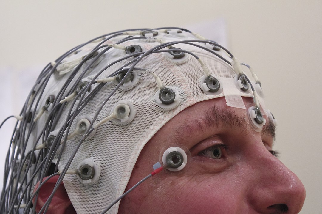 ЭЭГ может помочь в определении очага эпилептического припадка.
