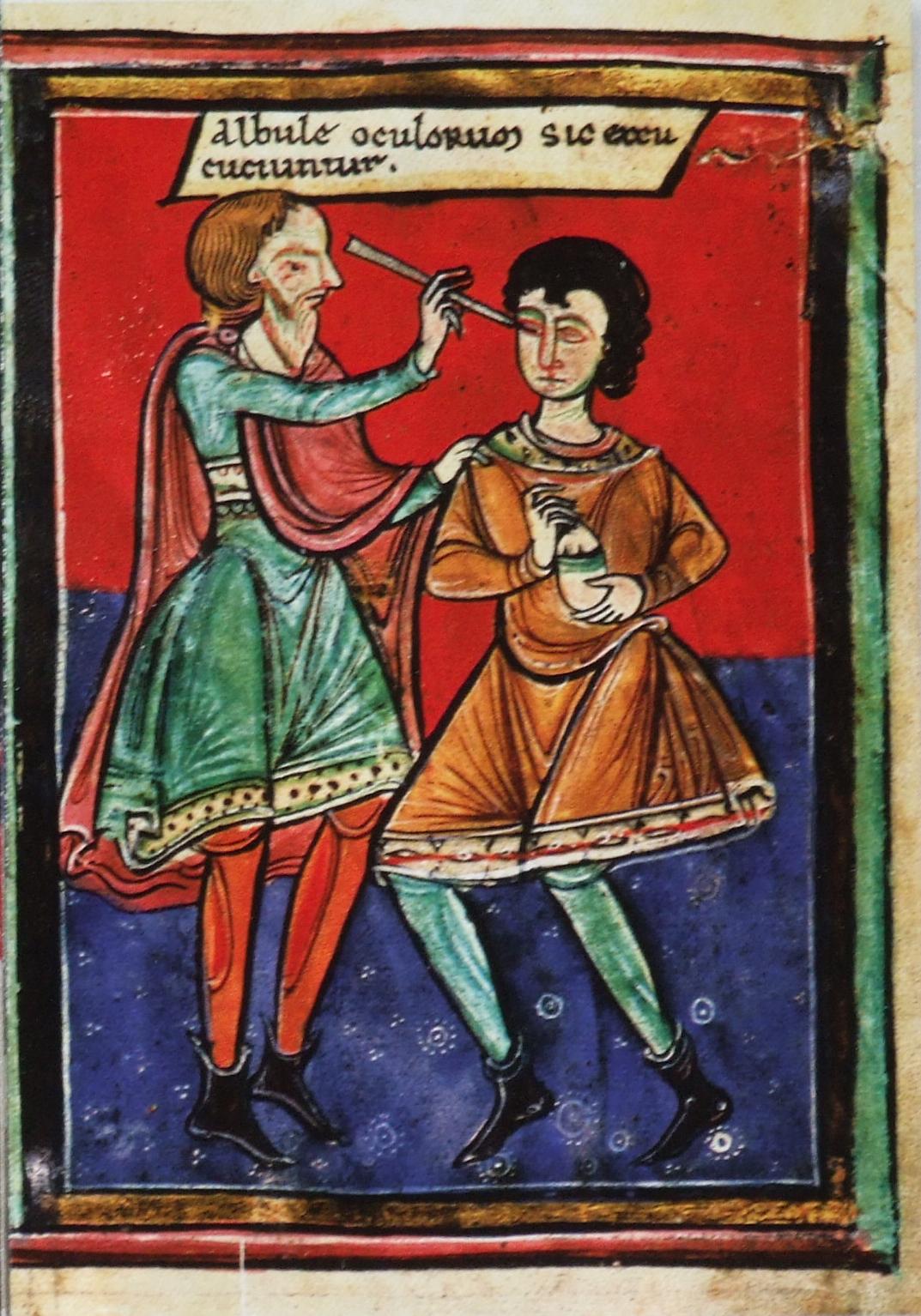 Операция на глазу (вероятно, удаление катаракты или вскрытие бельма), Albulae oculorum sic excutiuntur, 1195 г.