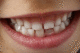 Здоровье и красота зубов с самого детства
