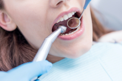 Как проходит восстановление зубов металлокерамическими коронками?